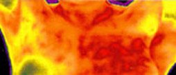FLIR A615 Medical