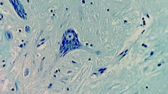 Nervous tissue (bright field) Nervous tissue (bright field)